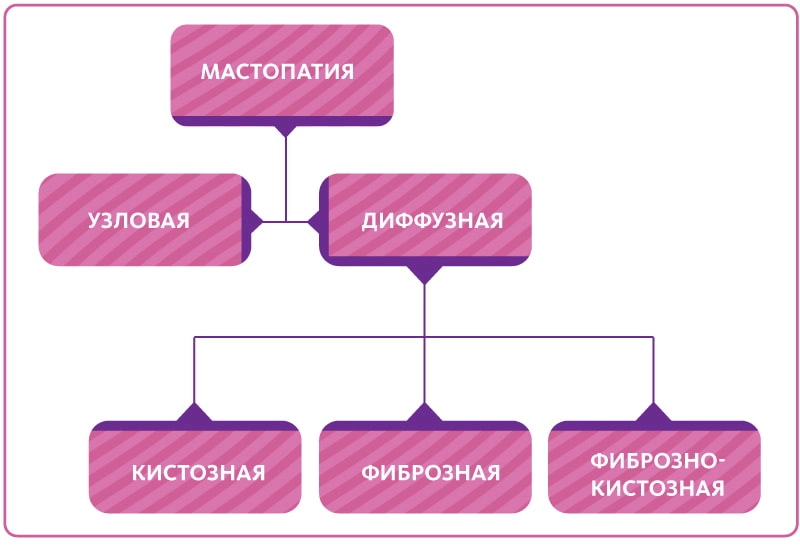 виды мастопатии